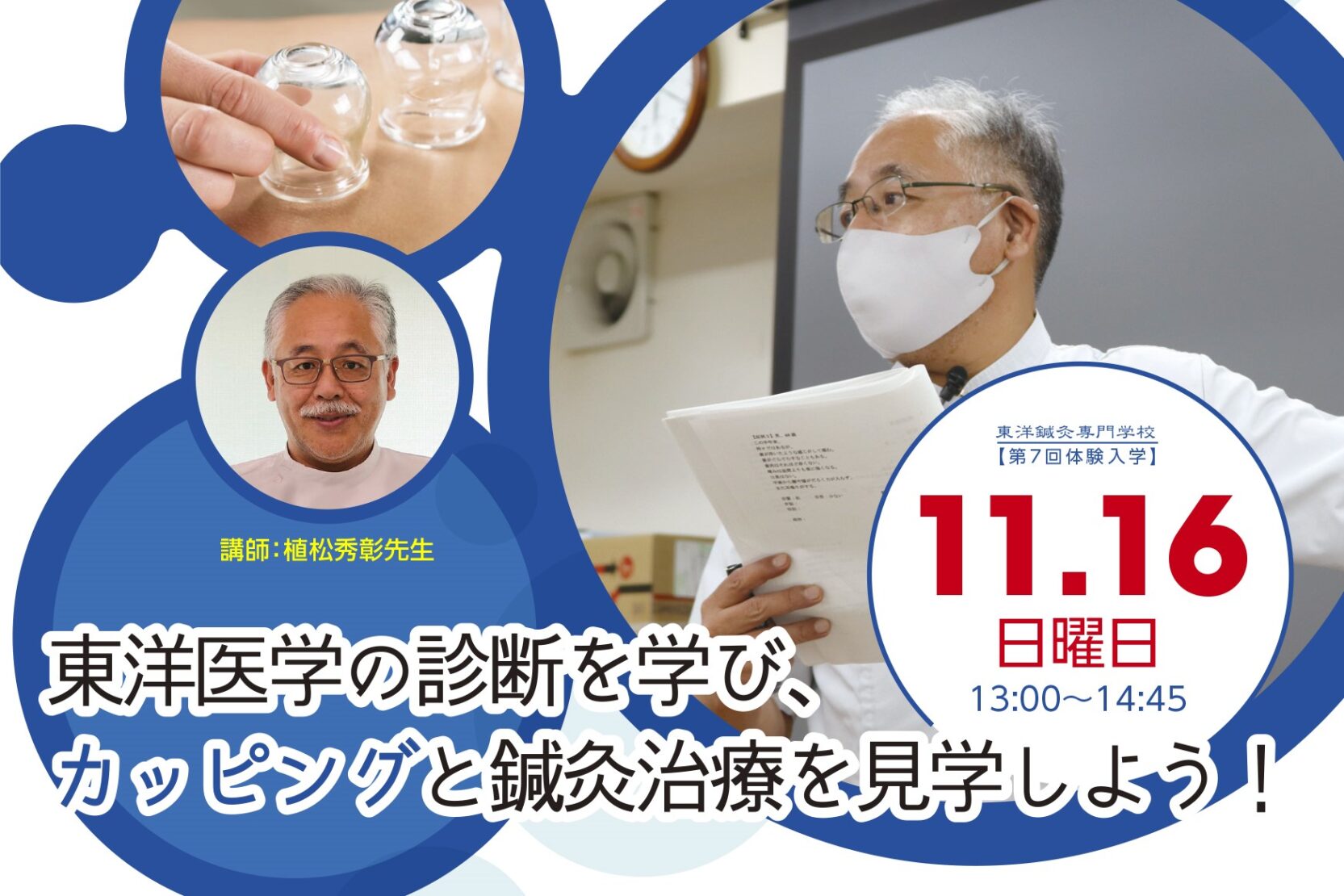13時【第7回体験入学】あなたは何タイプ？東洋医学の診断を学び、カッピングを見学しよう！